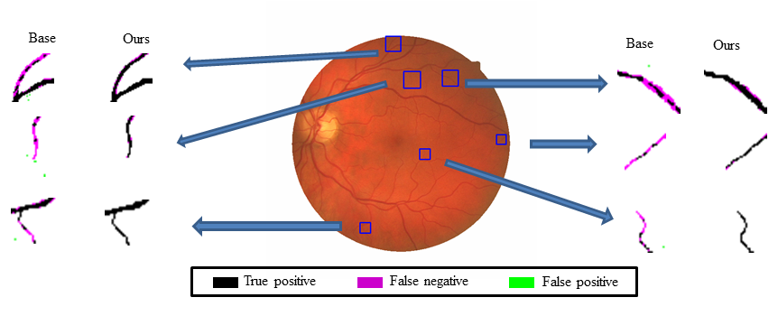 Example on retinal image