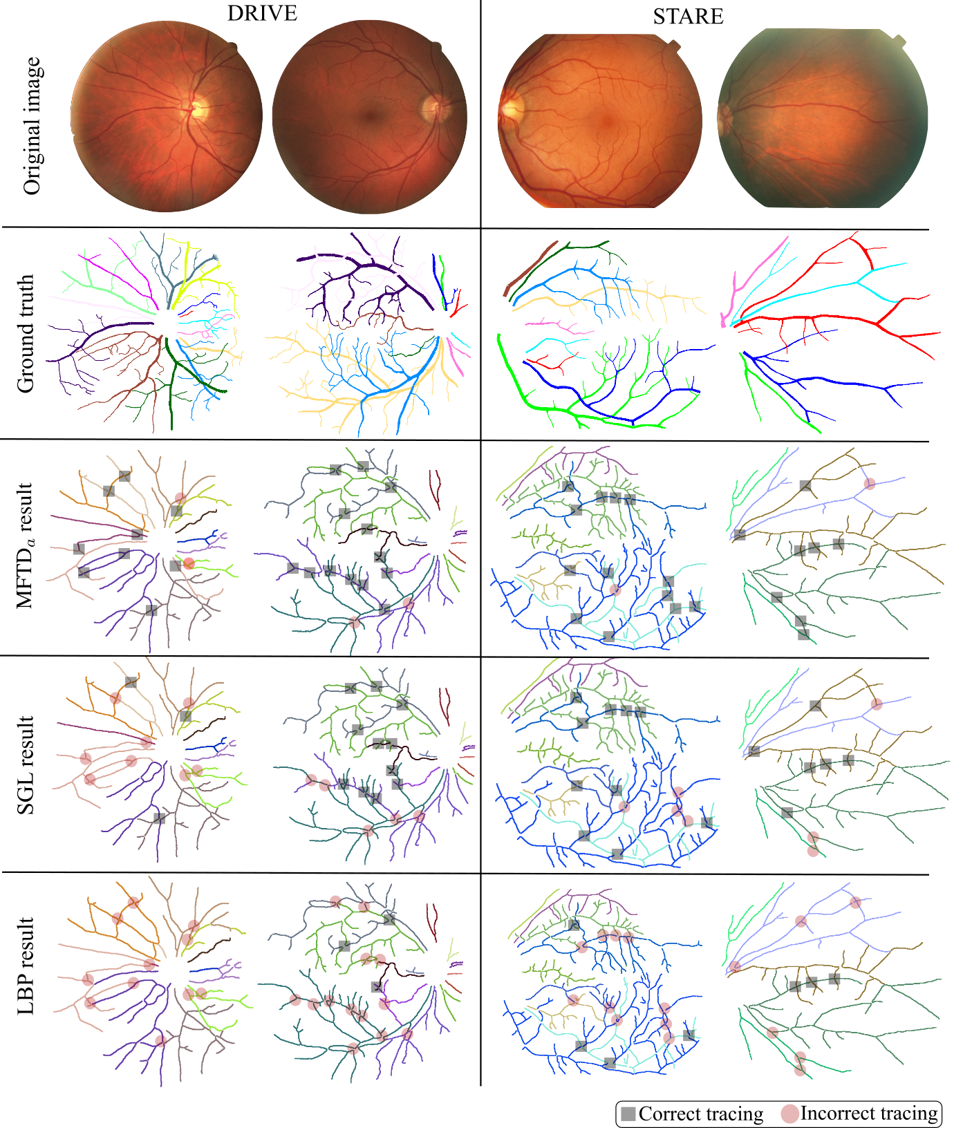 synthetic retinal tracing images